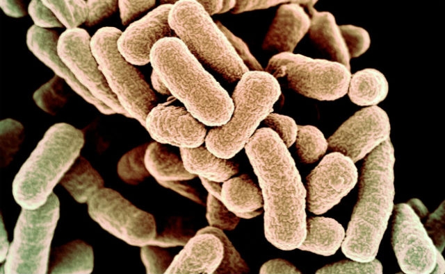 Los científicos crearon bacterias con un genoma sintético. ¿Es esta vida artificial?