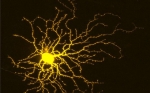 Los investigadores descubren pistas sobre cómo proteger las neuronas y estimular su crecimiento